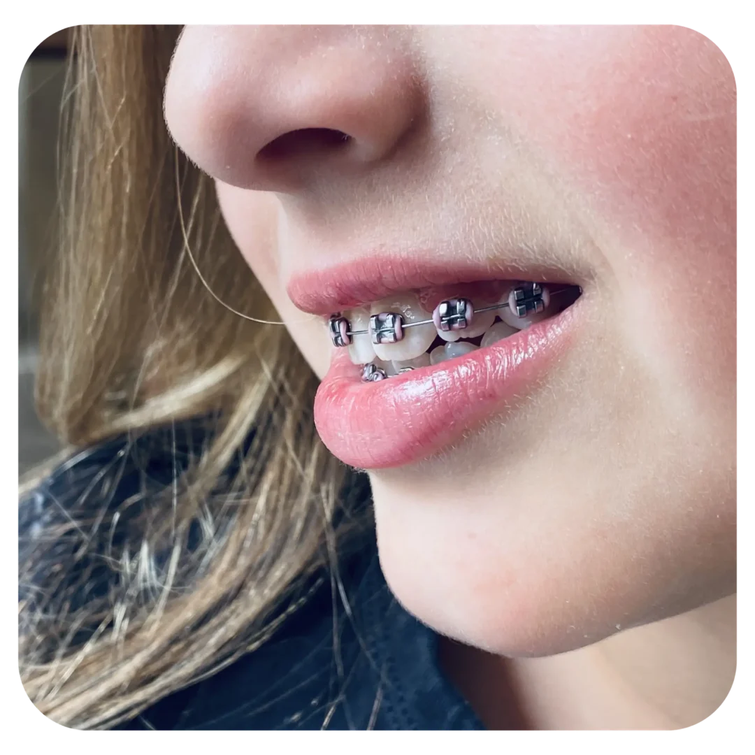 children orthodontist sydney