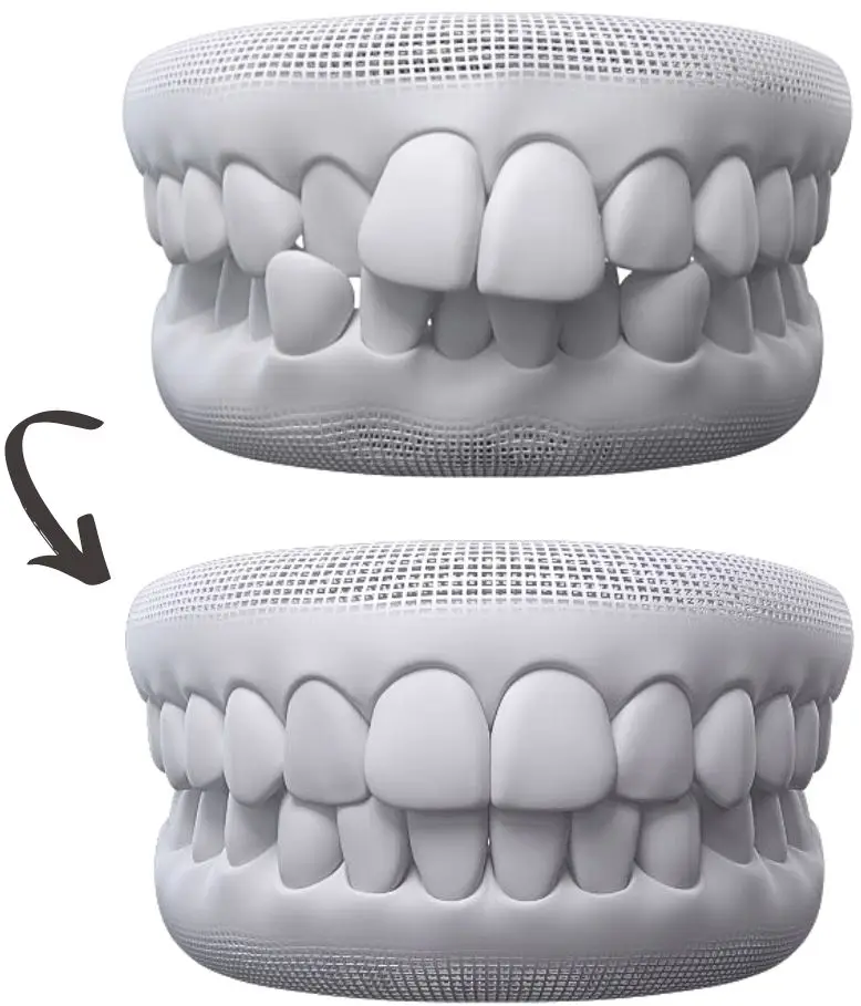 invisalign appointment sydney