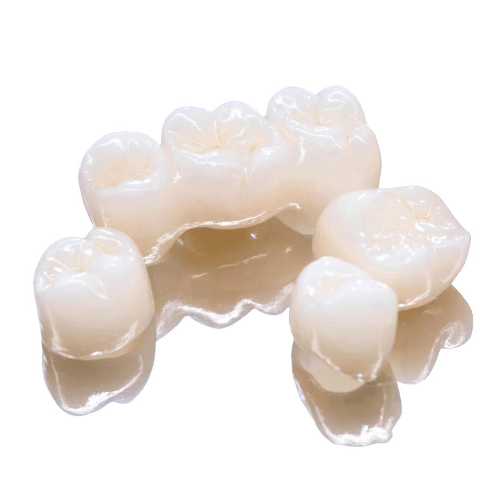 affordable dental bridge sydney