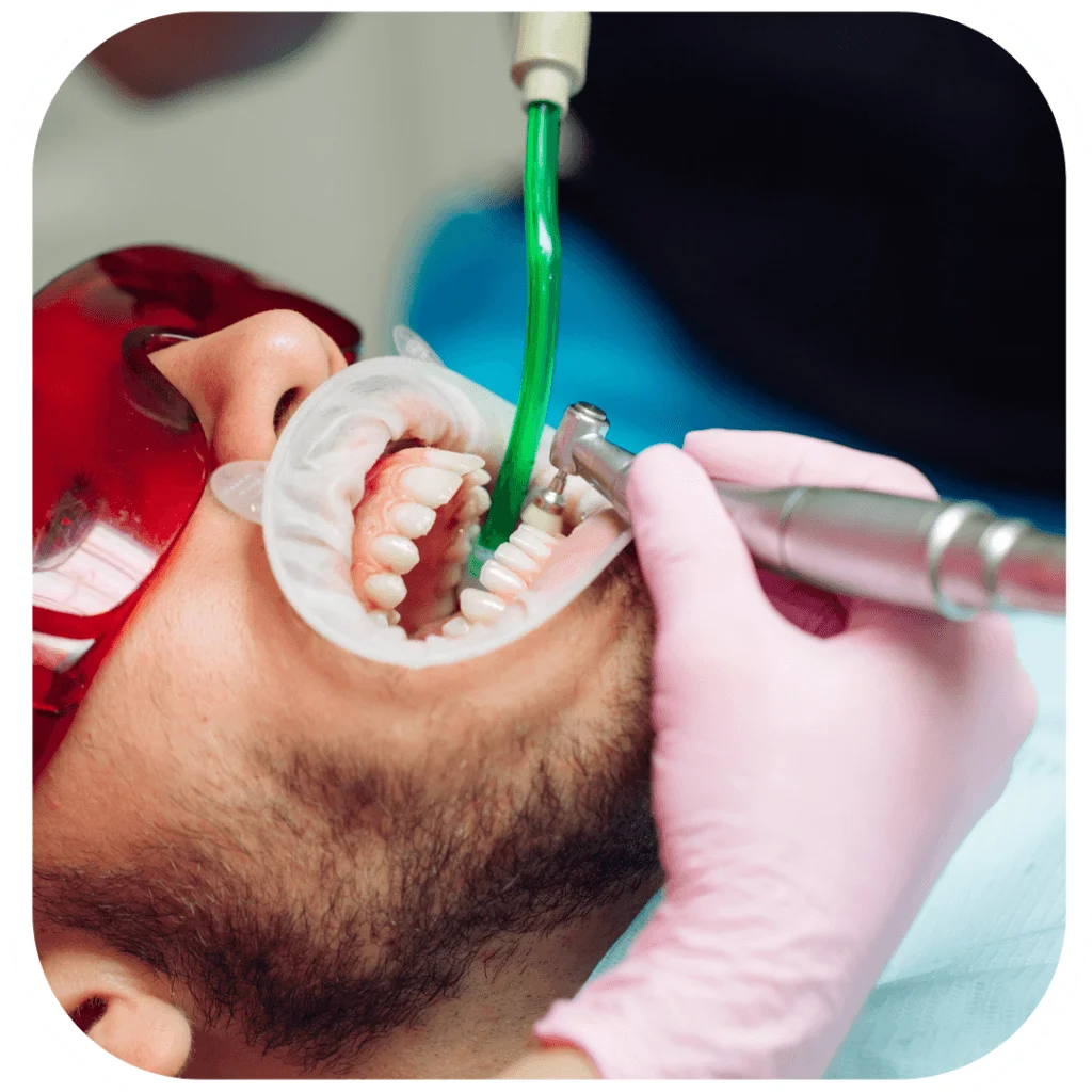 dental check up & clean sydney