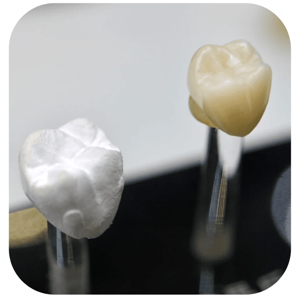dental crowns near me