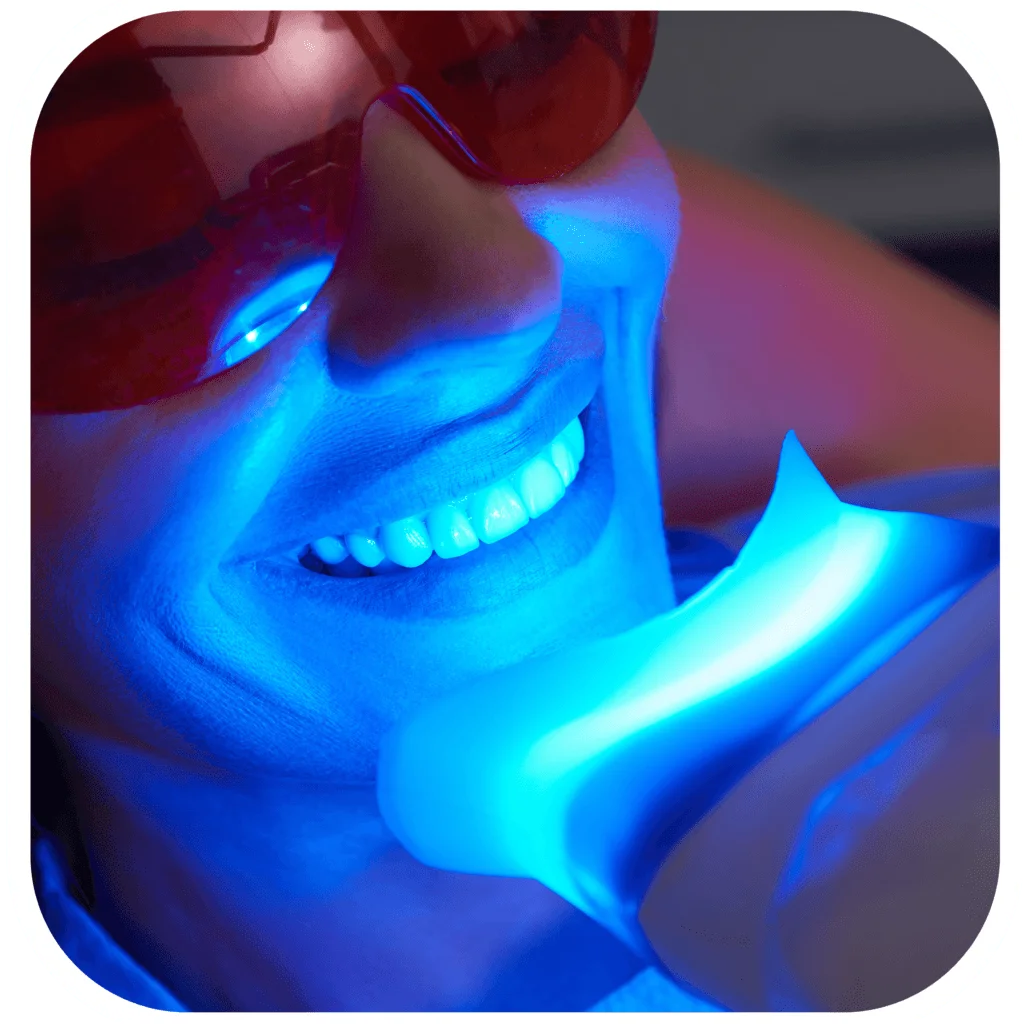 teeth whitening sydney